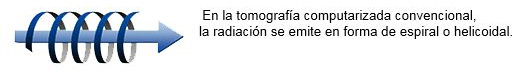 Tomografía Volumétrica Digital