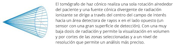 Tomografía Volumétrica Digital